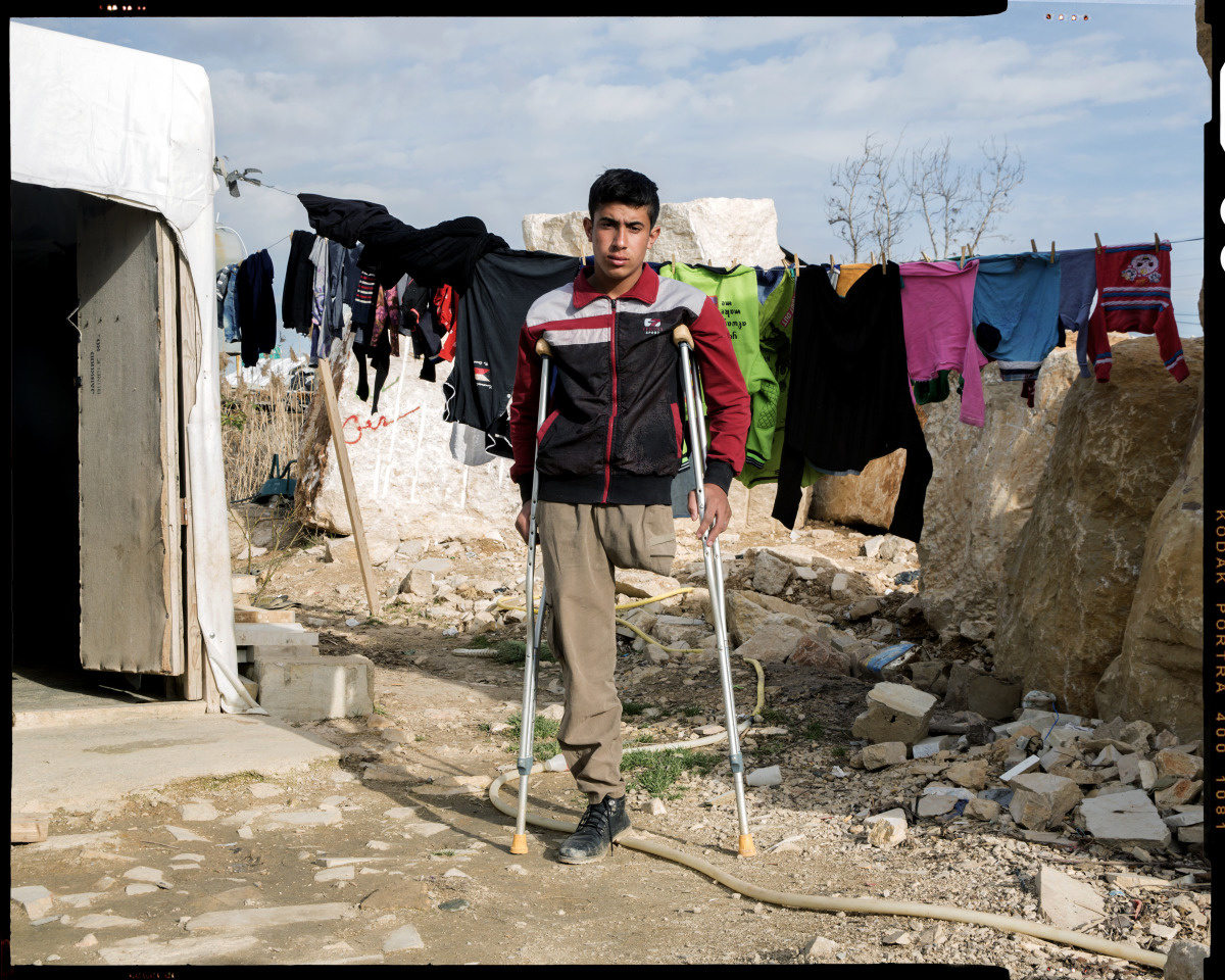 Hussein staat voor een simpel huisje. Hij steunt op zijn krukken en kijkt recht naar de camera. Op de achtergrond hangen kleren te drogen aan een waslijn. Er liggen veel losse stenen en brokstukken op de grond.