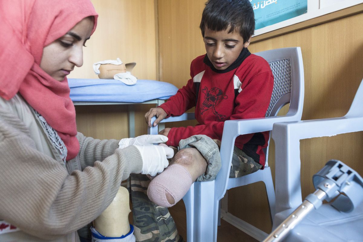 Een kleine jongen wordt aan zijn stomp net onder zijn linkerknie verzorgd door een kinesitherapeute van Handicap International. 