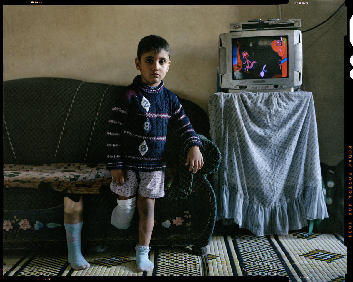 Khaled staat recht, steunend op zijn linkerbeen. De prothese voor zijn rechterbeen staat naast hem. Op de achtergrond toont een tv een tekenfilm.